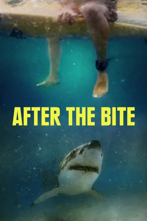 After the Bite | ฝังเขี้ยว ฝังใจ